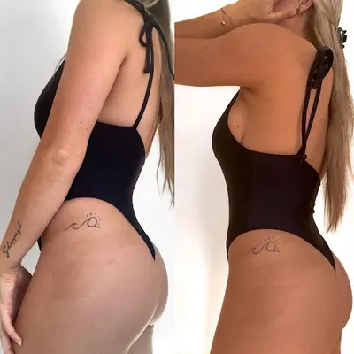 Opalanie Natryskowe by Daga Piotrków Tryb